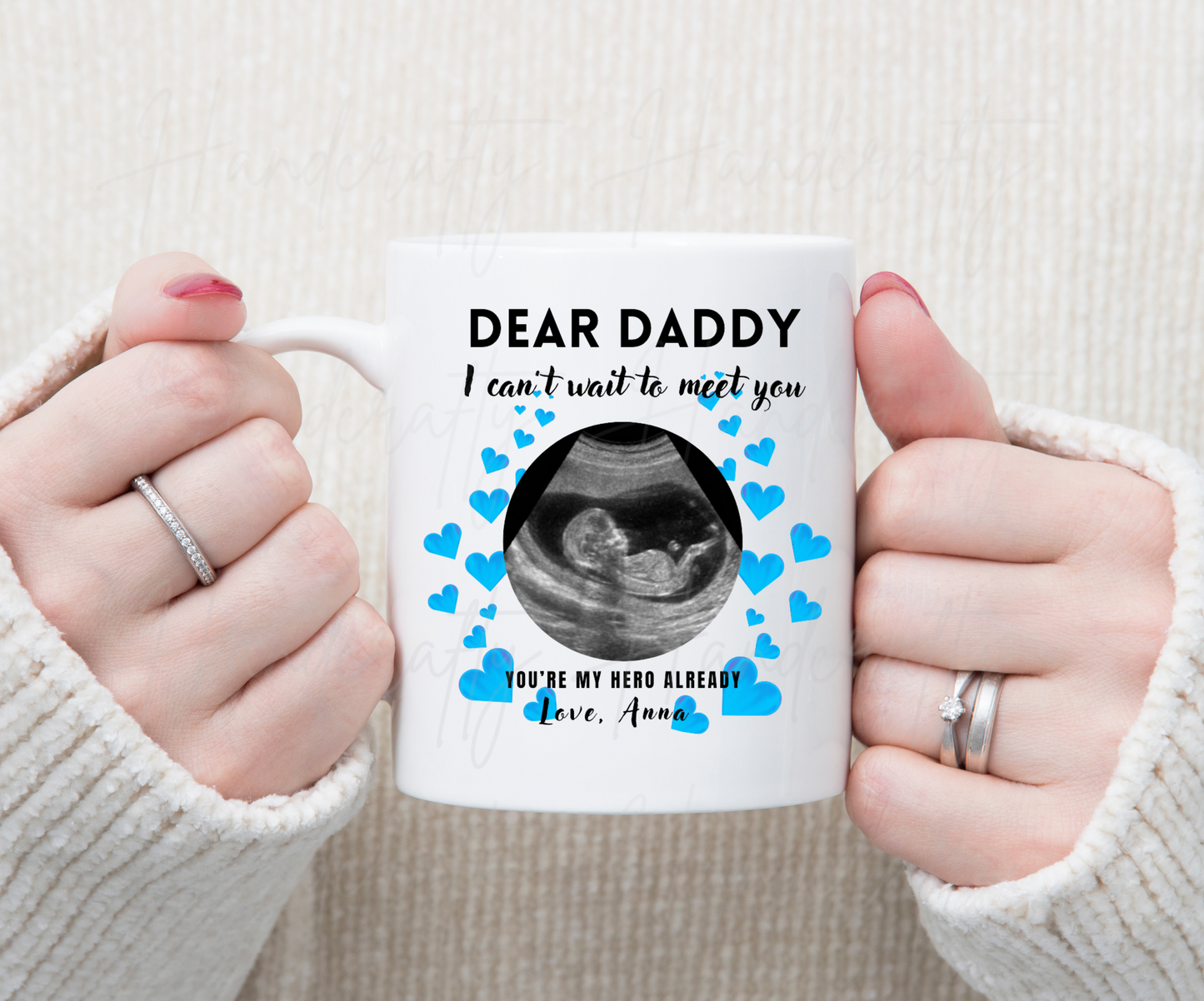Ultrasound coffee mug, Personalized coffee mug, coffee mug for first time parents, ultrasound gift, ultrasound mug, first father's day gift. Ultrasound personalized coffee mug, ultrasound customized coffee mug, first fathers day gift, gift for father
